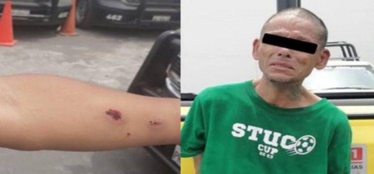 Ladrón ataca a mordidas a varios policías tras ser detenido en Monterrey