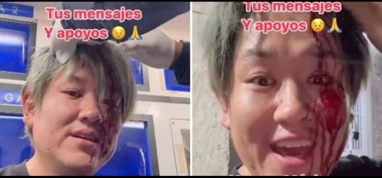 Japonés se vuelve viral tras ser asaltado en Monterrey